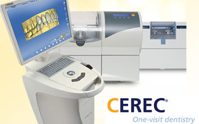 CEREC Crowns: Maintenance, Warranty, and Provisional Crowns