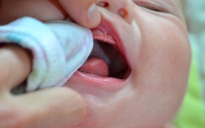 Prevention of Dental Disease in Infants and Children